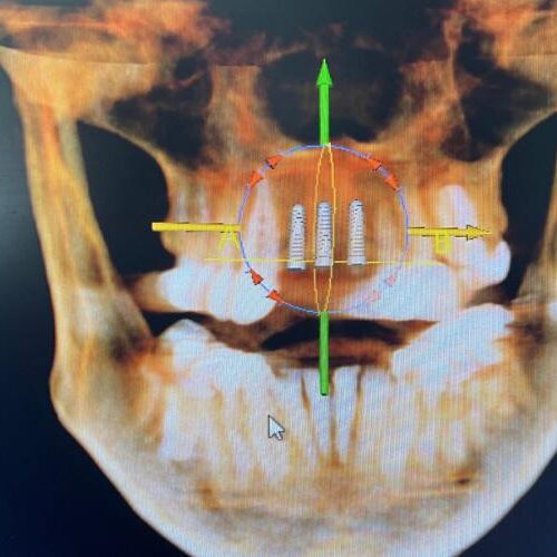 Dental Surgeons & Implant Center Cone Beam CT
