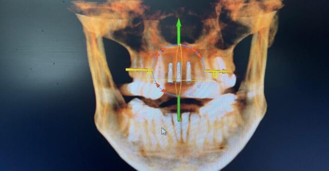 Dental Surgeons & Implant Center Cone Beam CT