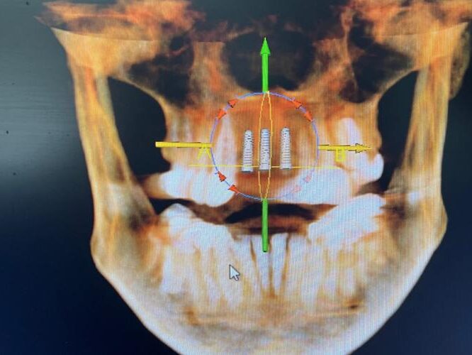 Cone Beam CT