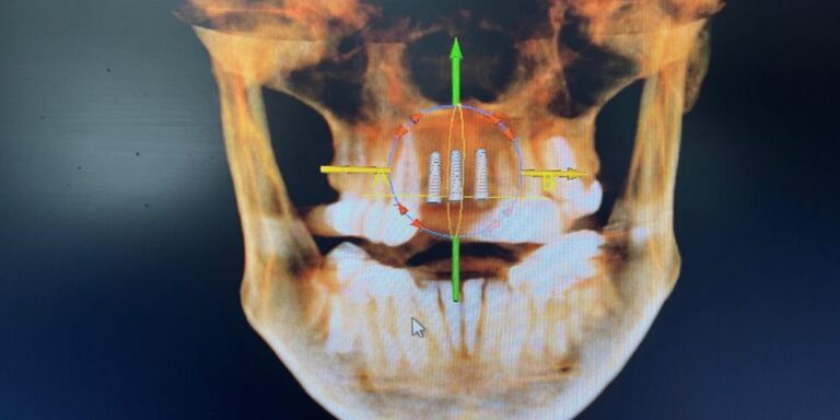 Dental Surgeons & Implant Center Cone Beam CT